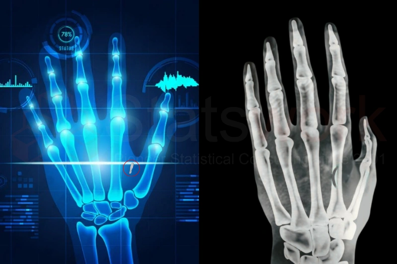 AI in healthcare